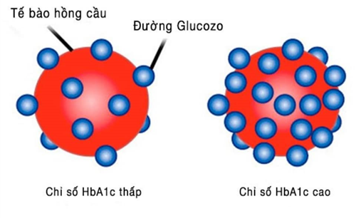 HbA1c  trong chẩn đoán bệnh tiểu đường
